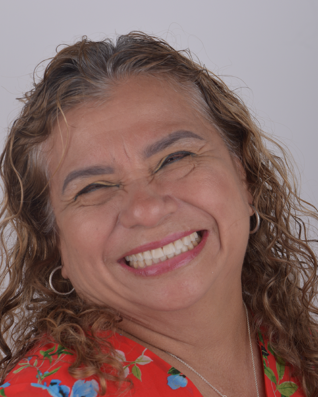CASO ESTETCA DENTAL