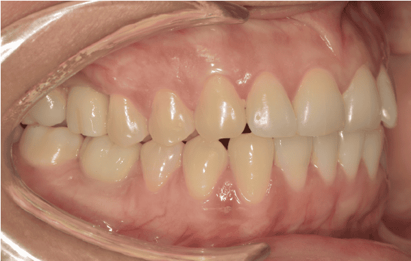 CASO 1 - Rehabilitacion-DESPUES_opt